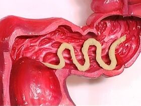 Pasożyty w ludzkim ciele, dlaczego się pojawiają
