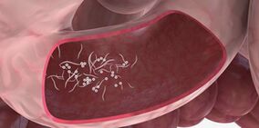 Użycie trojaczek do usuwania pasożytów