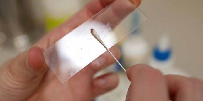 skrobanie skóry w poszukiwaniu pasożytów