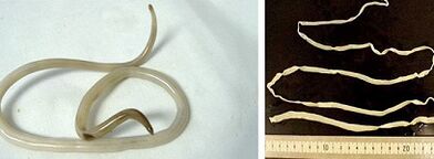 rodzaje pasożytów w organizmie człowieka