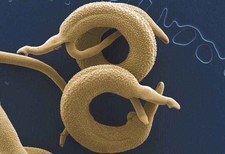 pasożyty żyjące w organizmie człowieka